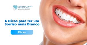 Sorriso Branco